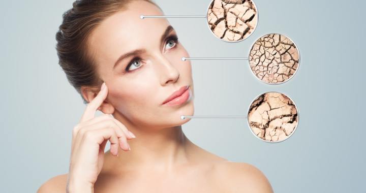 Dry Skin