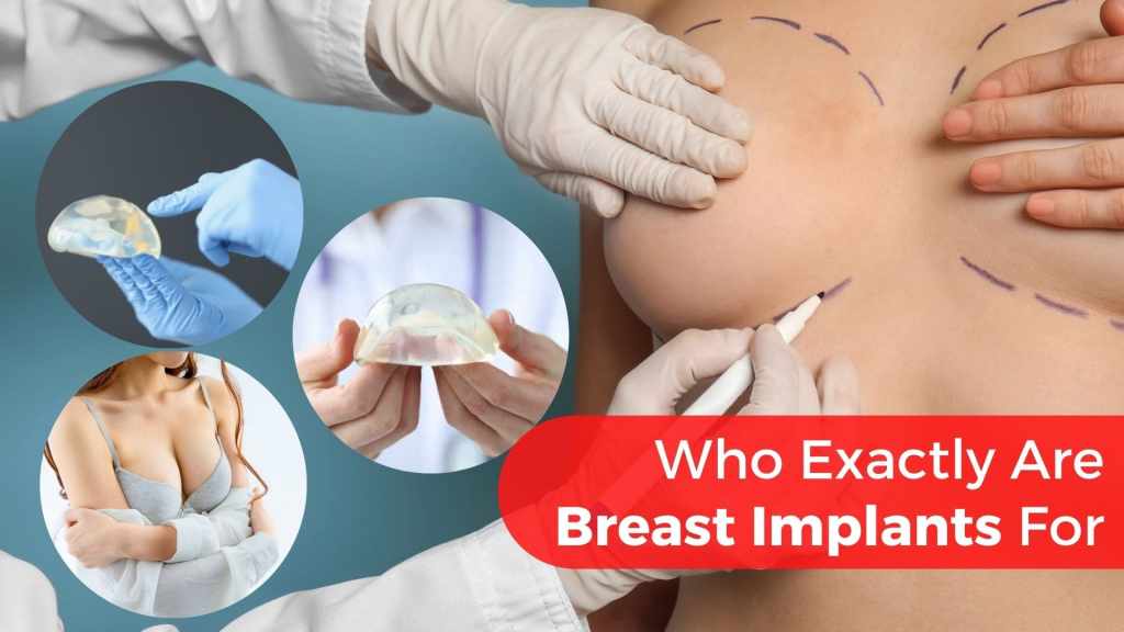 breast implants