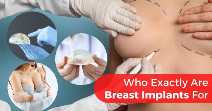 breast implants